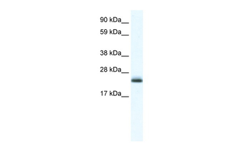 Tppp Rabbit Polyclonal Antibody