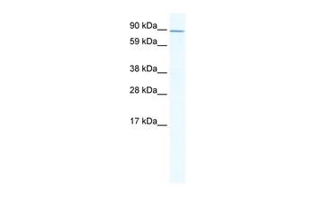 ZHX2 Rabbit Polyclonal Antibody