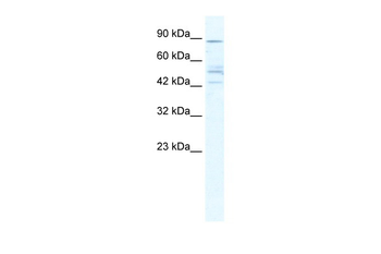 CHRNB2 Rabbit Polyclonal Antibody