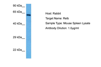 RELB Rabbit Polyclonal Antibody