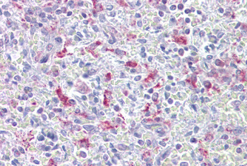 EZH1 Rabbit Polyclonal Antibody