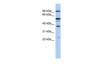 EZH1 Rabbit Polyclonal Antibody