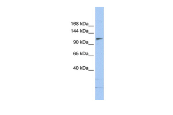 SMARCA5 Rabbit Polyclonal Antibody
