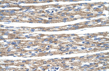 DLX5 Rabbit Polyclonal Antibody