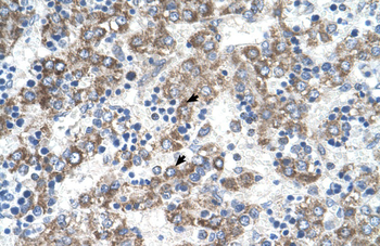 DLX5 Rabbit Polyclonal Antibody