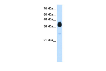 DLX5 Rabbit Polyclonal Antibody