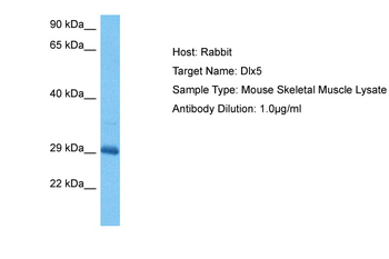 DLX5 Rabbit Polyclonal Antibody