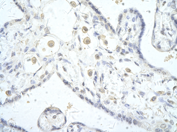 DLX5 Rabbit Polyclonal Antibody