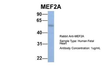 MEF2A Rabbit Polyclonal Antibody