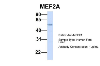 MEF2A Rabbit Polyclonal Antibody