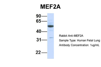 MEF2A Rabbit Polyclonal Antibody