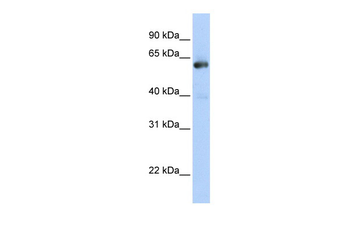 NAB1 Rabbit Polyclonal Antibody