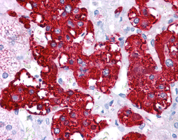 NR4A2 Rabbit Polyclonal Antibody
