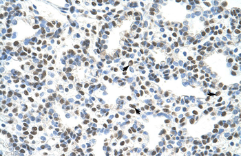 AKAP8L Rabbit Polyclonal Antibody