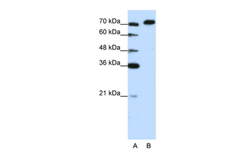 AKAP8L Rabbit Polyclonal Antibody