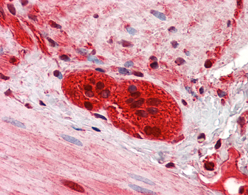 ZEB2 Rabbit Polyclonal Antibody