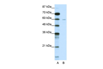 DCP1A Rabbit Polyclonal Antibody