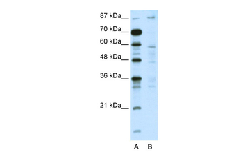 DMAP1 Rabbit Polyclonal Antibody