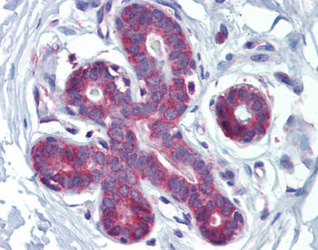 HOXA5 Rabbit Polyclonal Antibody