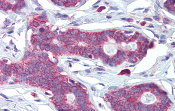 HOXA5 Rabbit Polyclonal Antibody