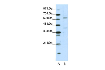 FOXP4 Rabbit Polyclonal Antibody
