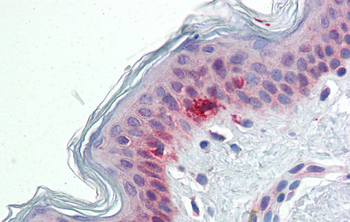 RAE1 Rabbit Polyclonal Antibody