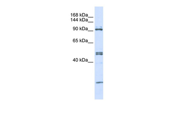 AARS Rabbit Polyclonal Antibody