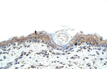 RBMS1 Rabbit Polyclonal Antibody
