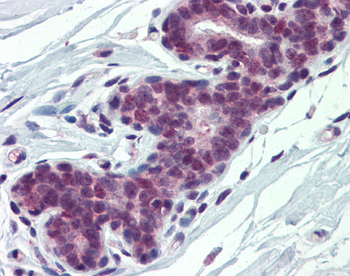 PCBP1 Rabbit Polyclonal Antibody