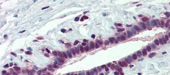 PCBP1 Rabbit Polyclonal Antibody