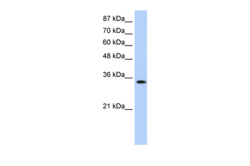 MBNL1 Rabbit Polyclonal Antibody