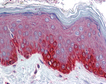 FZD4 Rabbit Polyclonal Antibody