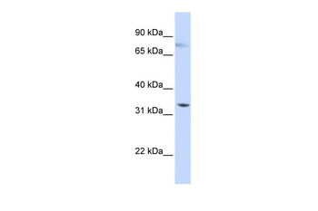 SIGLEC6 Rabbit Polyclonal Antibody