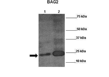BAG2 Rabbit Polyclonal Antibody