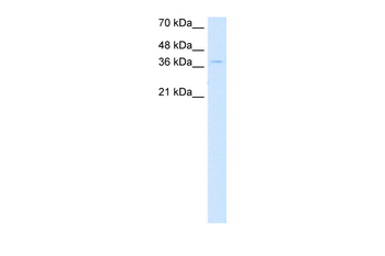 CTDSPL Rabbit Polyclonal Antibody