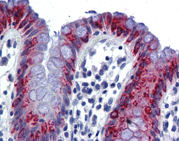 AGR2 Rabbit Polyclonal Antibody