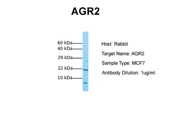 AGR2 Rabbit Polyclonal Antibody