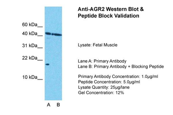AGR2 Rabbit Polyclonal Antibody