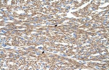 COX4I1 Rabbit Polyclonal Antibody