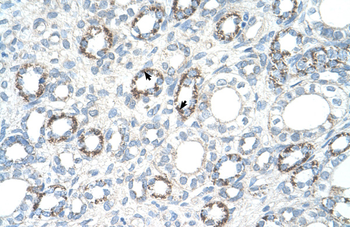 COX4I1 Rabbit Polyclonal Antibody