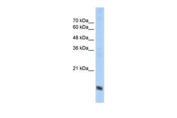 COX4I1 Rabbit Polyclonal Antibody