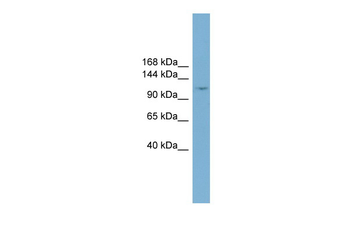 TRIM37 Rabbit Polyclonal Antibody