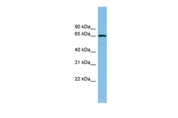 RAD18 Rabbit Polyclonal Antibody