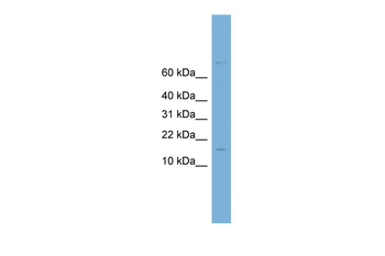 UBE2C Rabbit Polyclonal Antibody