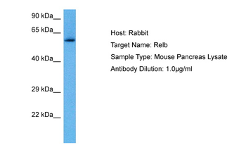 RELB Rabbit Polyclonal Antibody