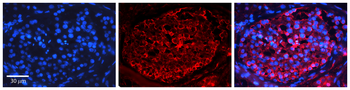 PTCH1 Rabbit Polyclonal Antibody