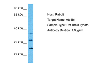 ATP1B1 Rabbit Polyclonal Antibody