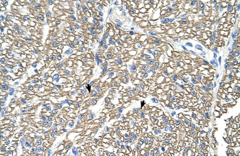 ATP1B1 Rabbit Polyclonal Antibody
