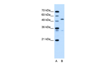 PODXL Rabbit Polyclonal Antibody