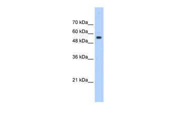 PODXL Rabbit Polyclonal Antibody
